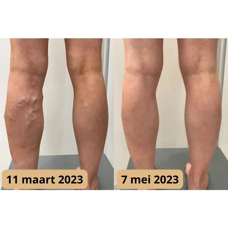 Voetmassage mat – opvouwbaar ontwerp met EMS-functie & afstandsbediening