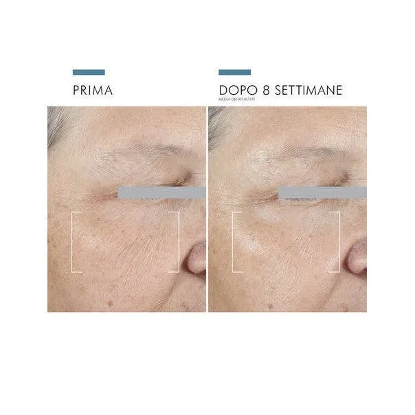 SkinCeuticals A.G.E Advanced Eye Crema Contorno Occhi Antirughe 15ml