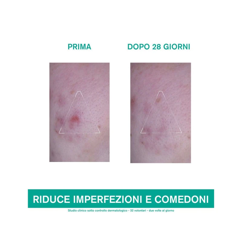 Uriage Hyseac 3 Regul+ Trattamento Globale Anti-imperfezioni 40ml