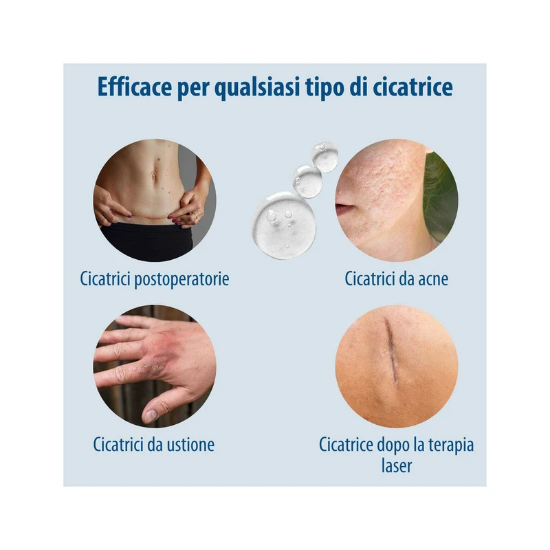 Evolsin Gel Silicone Per Cicatrici Per Bambini E Adulti 20g