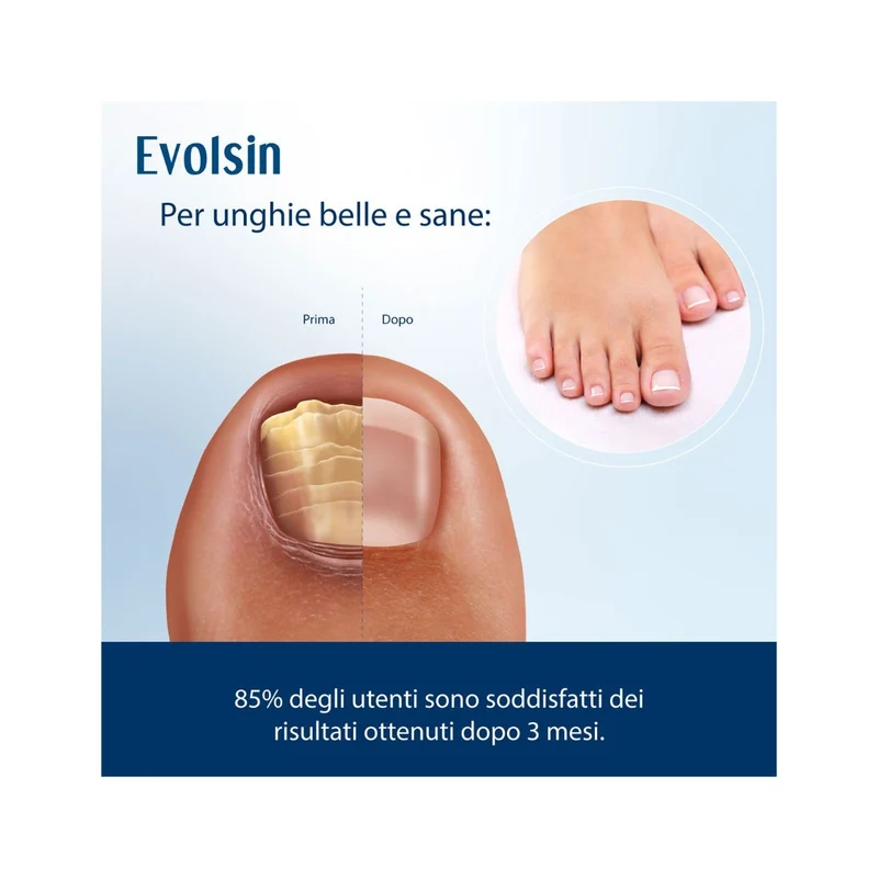 Evolsin Liquido Antimicotico per Unghie 10ml