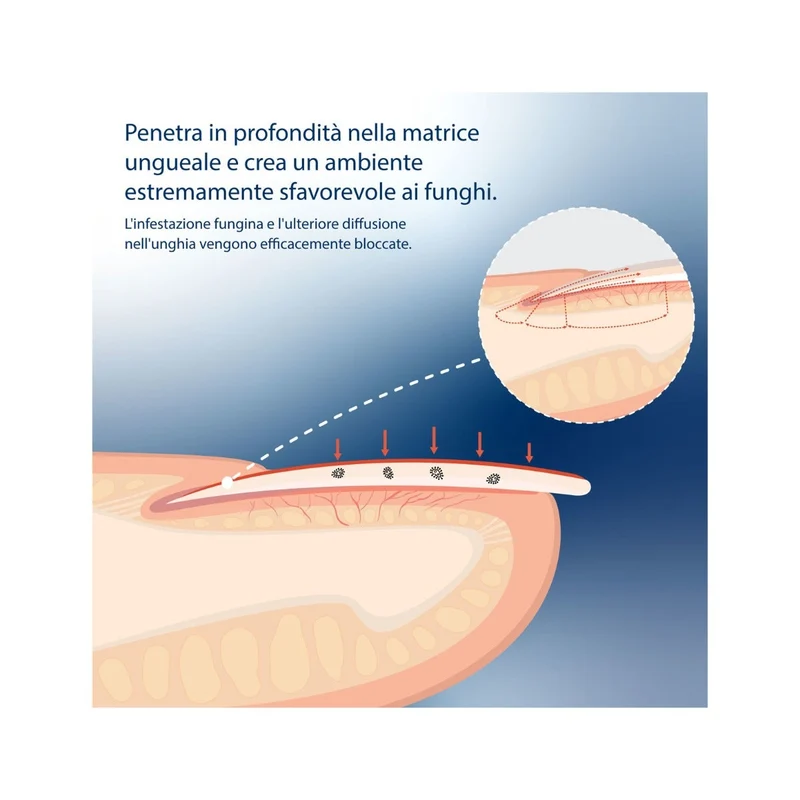 Evolsin Liquido Antimicotico per Unghie 10ml