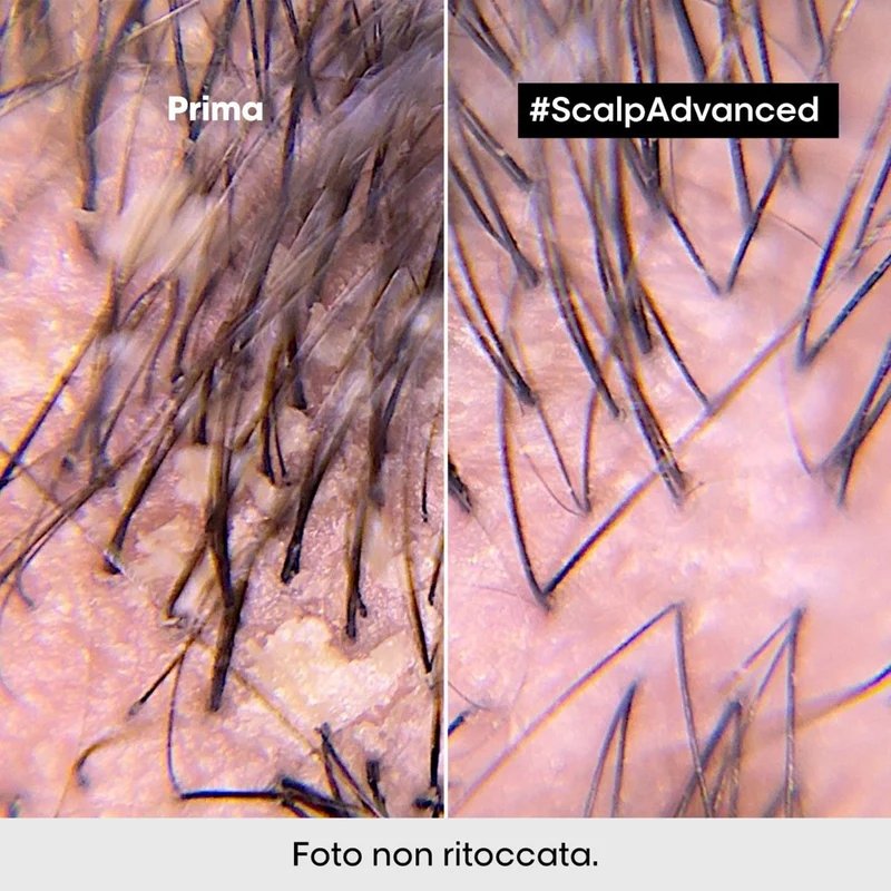 Scalp Advanced Shampoo Dermo-Clarifier