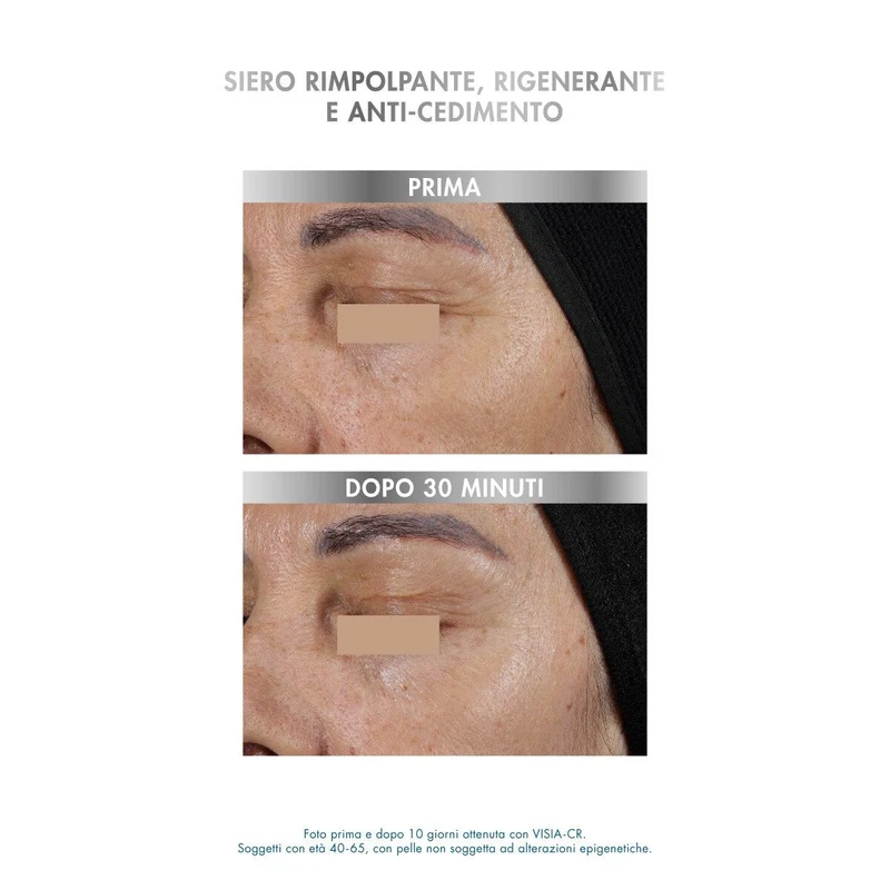 Miamo Epigenage Shot Epigenetic Formula 10 Siringhe Da 1ml