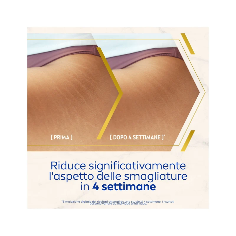 Nivea Luminous630 Olio-siero Corpo Antismagliature Per La Cura Corpo 100ml