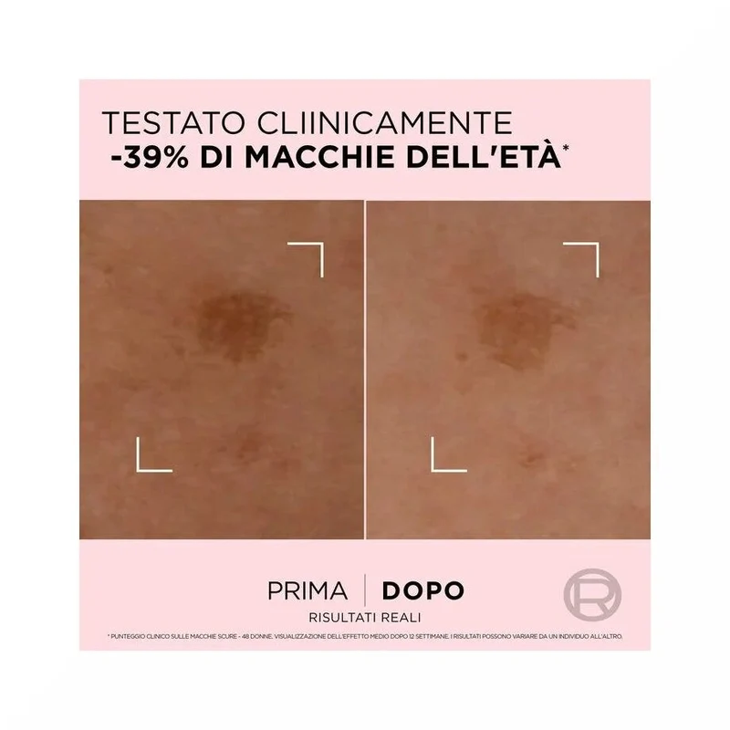 L'Oreal Paris Age Perfect Siero Correttore Anti Macchie 30ml
