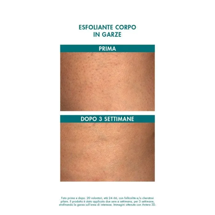 Miamo Alpha Blend 13% Esfoliante Corpo Garze Imbevute 6 Bustine