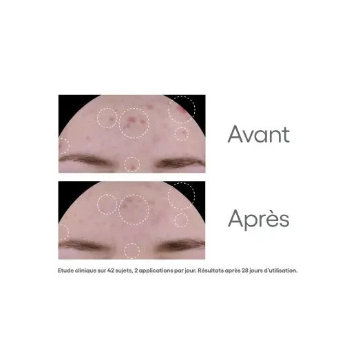 A-Derma Biology Ac Trattamento Opacizzante Anti-imperfezioni 40ml
