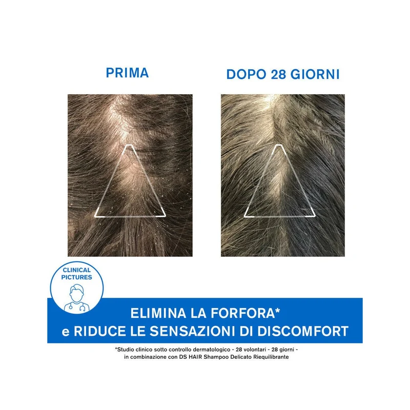 Uriage DS Hair Trattamento Antiforfora 200ml