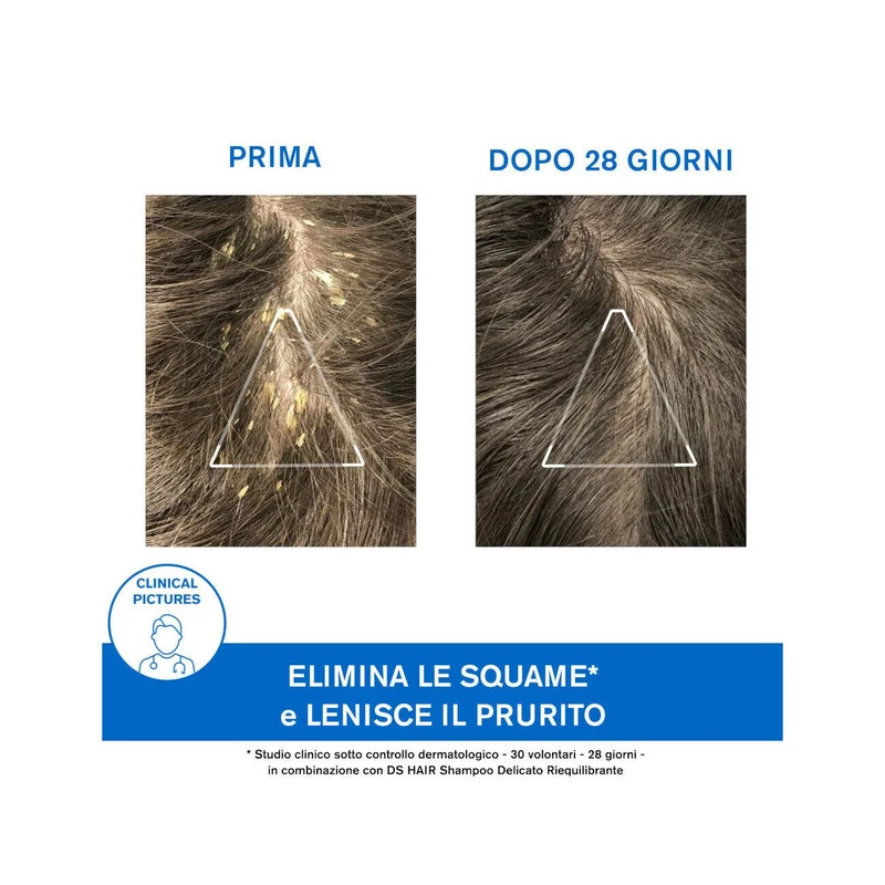 Uriage DS Hair Shampoo Trattamento Cheratoriduttore 150ml